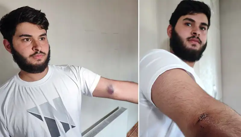 Bahçeye Kaçan Top, Mahallede Neden Olay Yarattı?